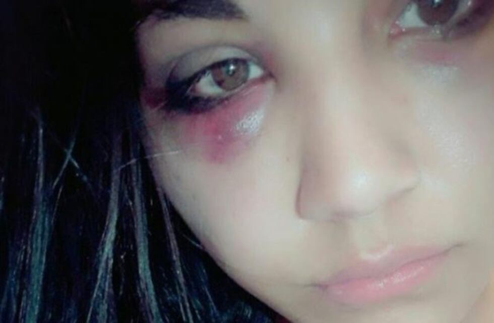 Denuncian un violento ataque a tres chicas en un boliche de Don Torcuato