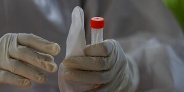 Yangon (Myanmar), 05/10/2020\u002E- A medical worker wearing PPE (Personal Protective Equipment) prepares to seal a swab sample at a COVID-19 testing lab at a community quarantine center in Yangon, Myanmar, 05 October 2020\u002E Myanmar is trying to control the spread of infections at its biggest city Yangon, currently under lockdown, as the capital'Äôs region became the country'Äôs outbreak epicenter after a surge in coronavirus cases\u002E (Laos, Birmania) EFE/EPA/LYNN BO BO