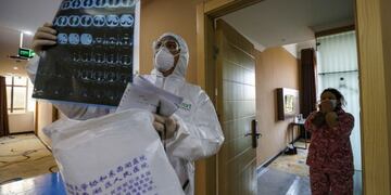 Coronavirus pulmones