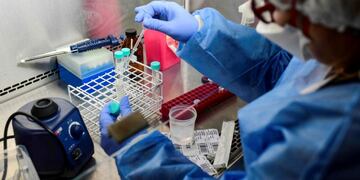 A doctor handles a COVID-19 test at the Professor Alejandro Posadas National Hospital in the municipality of El Palomar, province of Buenos Aires, on September 18, 2020, amid the novel coronavirus pandemic\u002E - The pandemic has killed at least 946,727 people worldwide, including more than 12,000 in Argentina, since emerging in China late last year, according to an AFP tally at 1100 GMT Friday based on official sources\u002E (Photo by Ronaldo SCHEMIDT / AFP)
