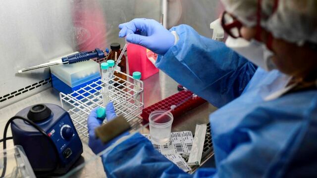 A doctor handles a COVID-19 test at the Professor Alejandro Posadas National Hospital in the municipality of El Palomar, province of Buenos Aires, on September 18, 2020, amid the novel coronavirus pandemic\u002E - The pandemic has killed at least 946,727 people worldwide, including more than 12,000 in Argentina, since emerging in China late last year, according to an AFP tally at 1100 GMT Friday based on official sources\u002E (Photo by Ronaldo SCHEMIDT / AFP)