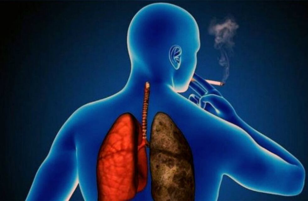 Se realizarán en Salta estudios para detectar pacientes con EPOC