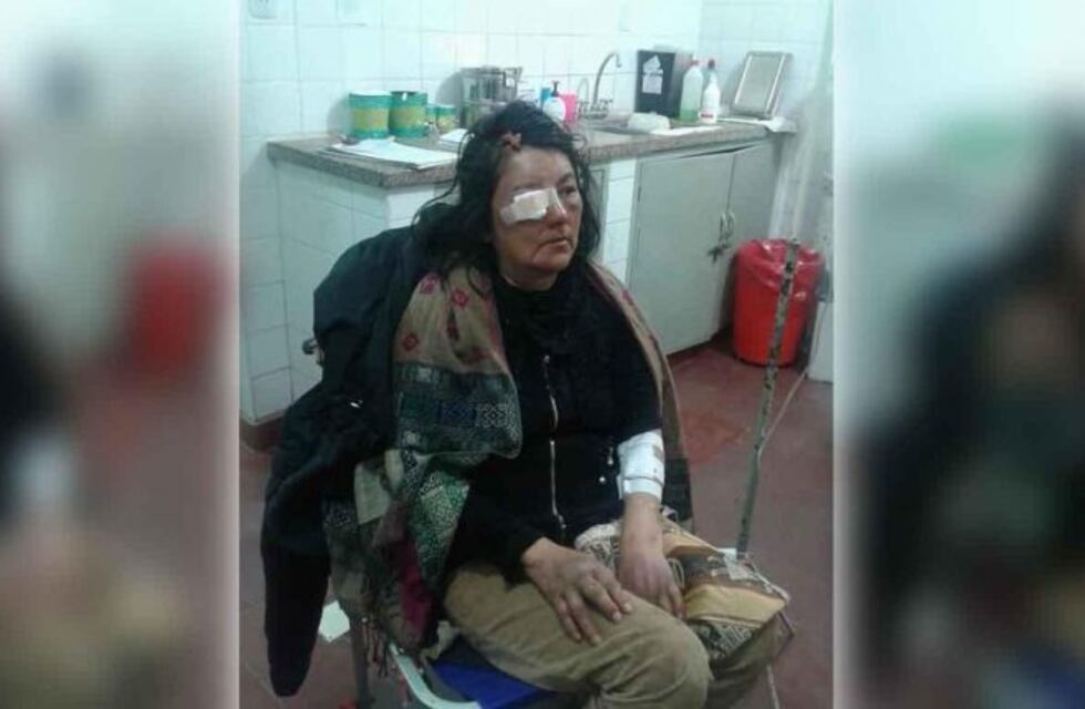 Salta: entraron a robar en una escuela rural y golpearon a su Directora