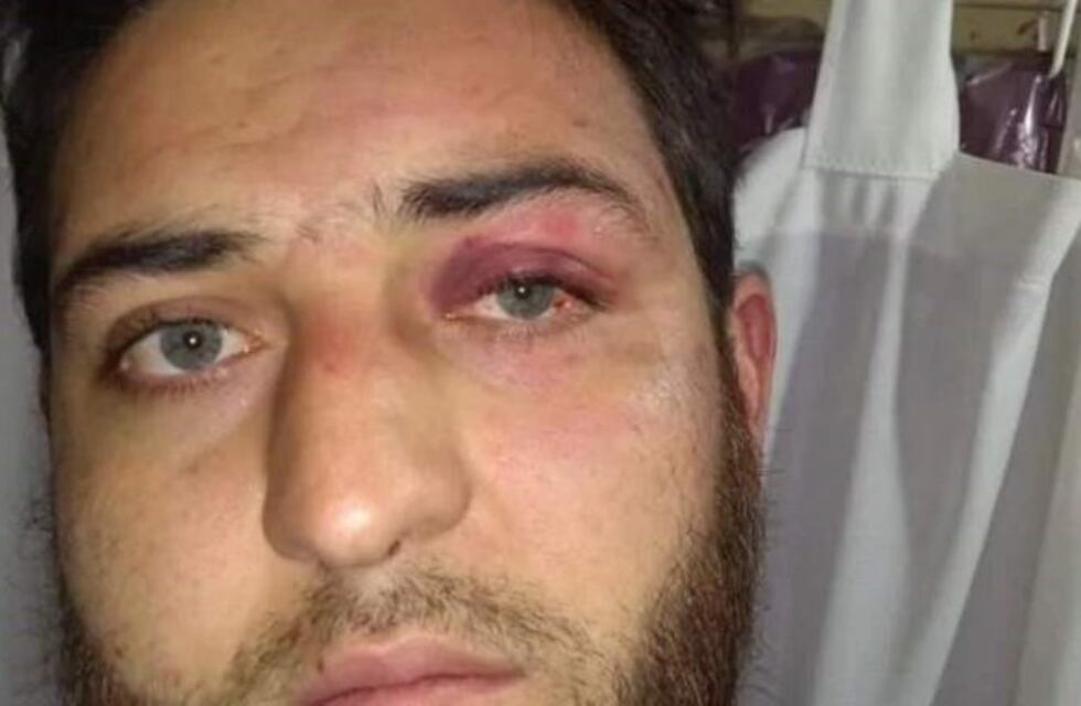 Procesaron a 6 policías por la brutal golpiza a un joven en una comisaría