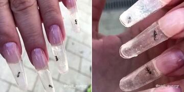 Hormigas en las uñas
