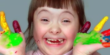 21 de marzo, Día Mundial del Síndrome de Down