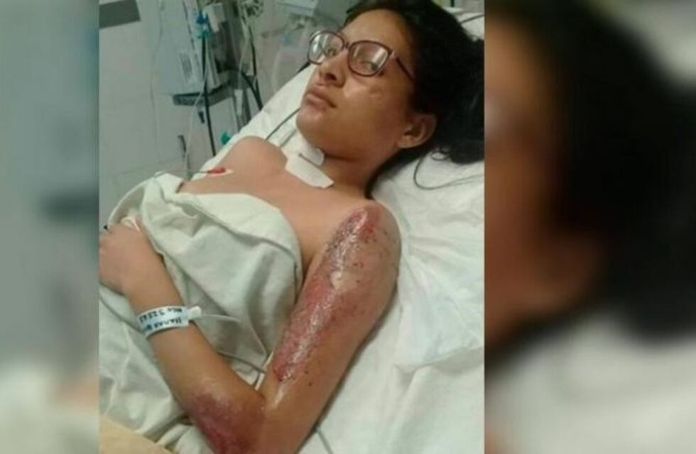 Piden ayuda para localizar al conductor que atropelló a una joven y huyó