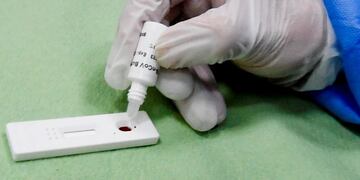 Naples (Italy), 01/04/2020\u002E- Medical staff of the Cardarelli hospital in Naples, southern Italy, 01 April 2020, perform rapid tests on blood samples to detect whether infected with the coronavirus disease (COVID-19) or not\u002E According to media reports quoting the director of the regional blood center and director of the transfusion center of the Cardarelli hospital in Naples, Michele Vacca, the rapid tests -- detecting the presence of antibodies against the COVID-19 -- give a result in ten minutes\u002E The medical procedure is considered to be very important for mass screening, helping identifying and give health workers reassurance that in case of a negative result, they can return to their activities, he added\u002E The test is said to be very precise on the negativity result, explained Vacca, while on the positive, a normal test is also performed for safety\u002E (Italia, Nápoles) EFE/EPA/CIRO FUSCO