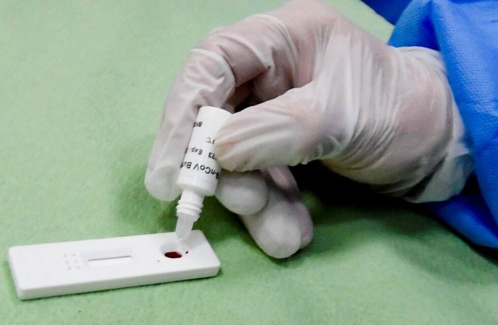 Un nuevo caso de coronavirus se confirmó en Tucumán y suma 29 infectados