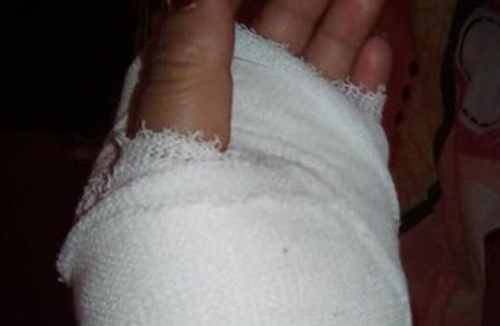 Ladrones le clavaron un destornillador en el cuello y en sus manos para robarle la moto