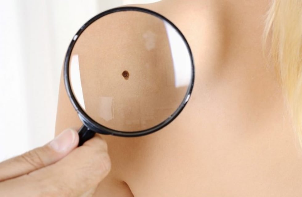 Dermatólogos atenderán gratis en Salta