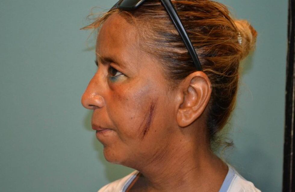 Denunció a su vecino por venta de droga y fue amenazada