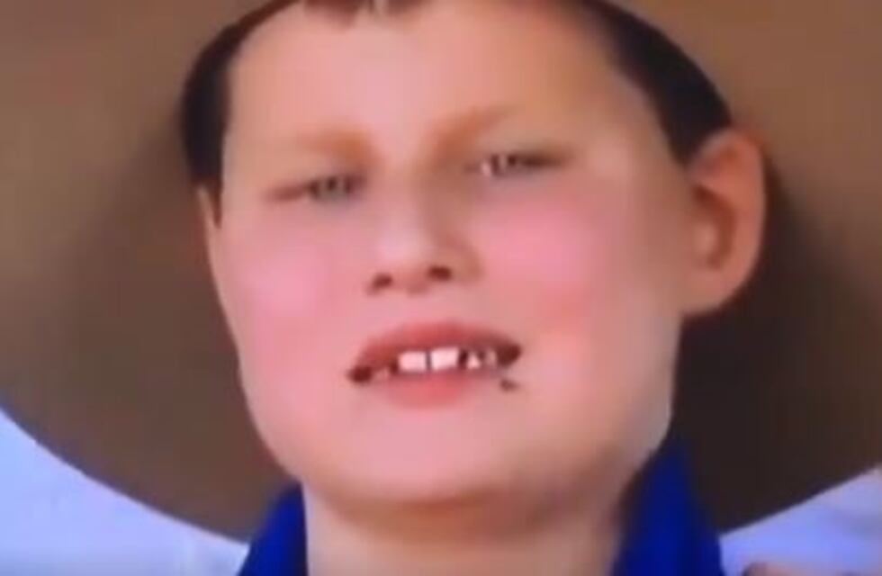 "El niño sapo" que se hizo viral por comer moscas durante una entrevista en televisión