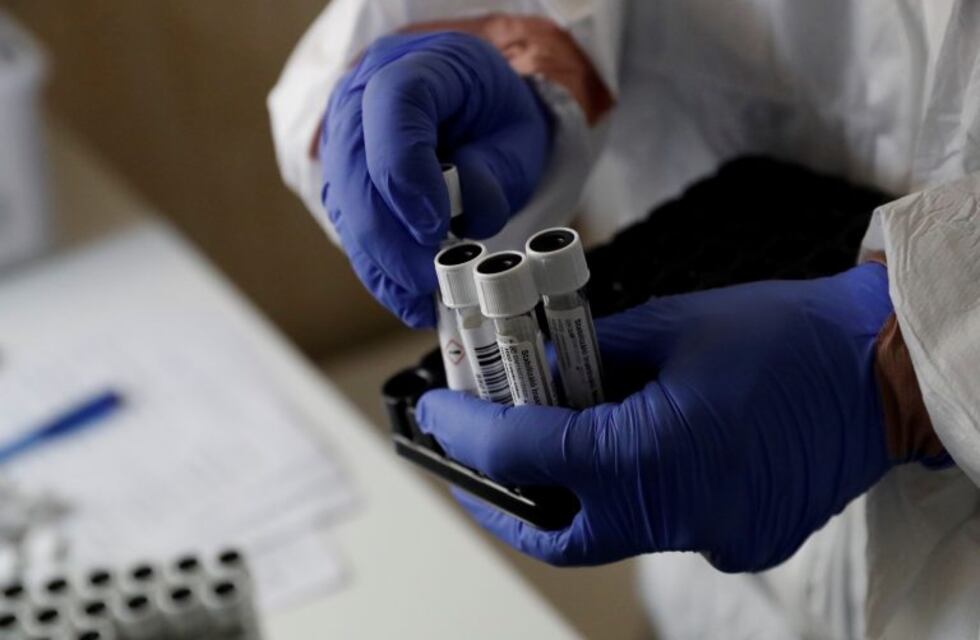 Coronavirus en Salta: el lunes sólo se registraron 93 casos positivos