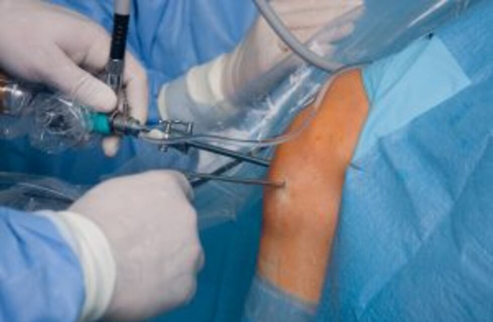 Ordenaron sacar de la venta insumos médicos fabricados en Rosario que no tenían habilitación de la ANMAT