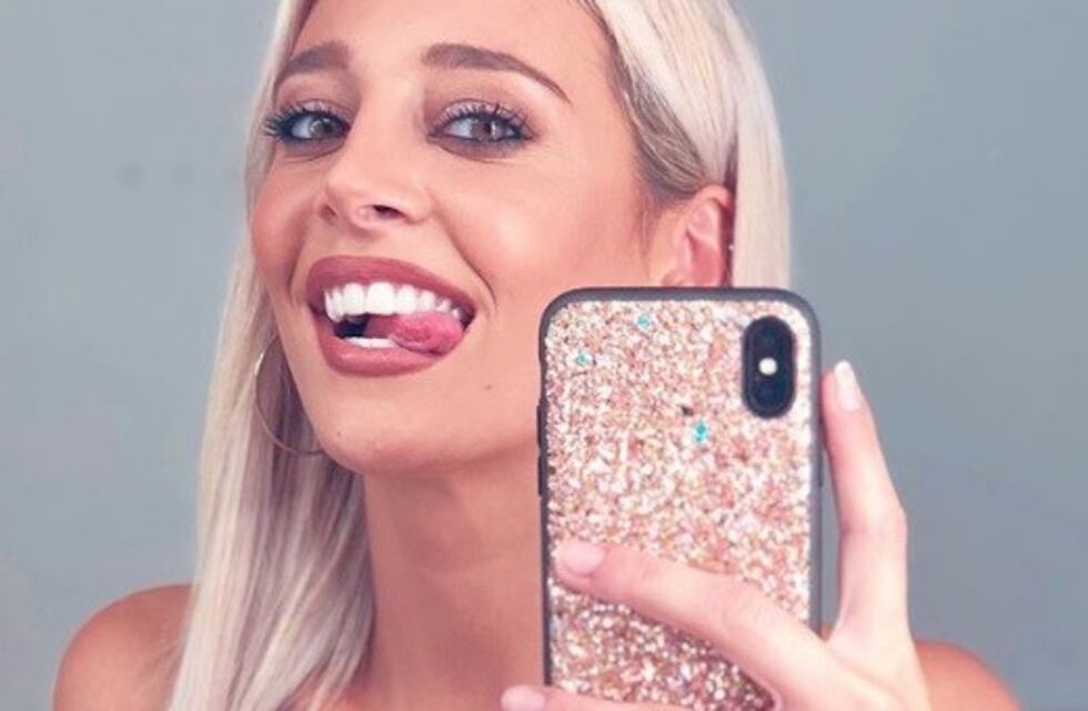 Quién es Matías Gelpi, el nuevo novio de Sol Pérez que le rompió la boca en vivo