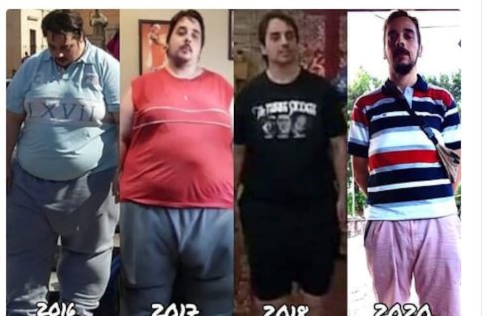 Charlas abiertas en el Madariaga para personas con obesidad, desde mañana