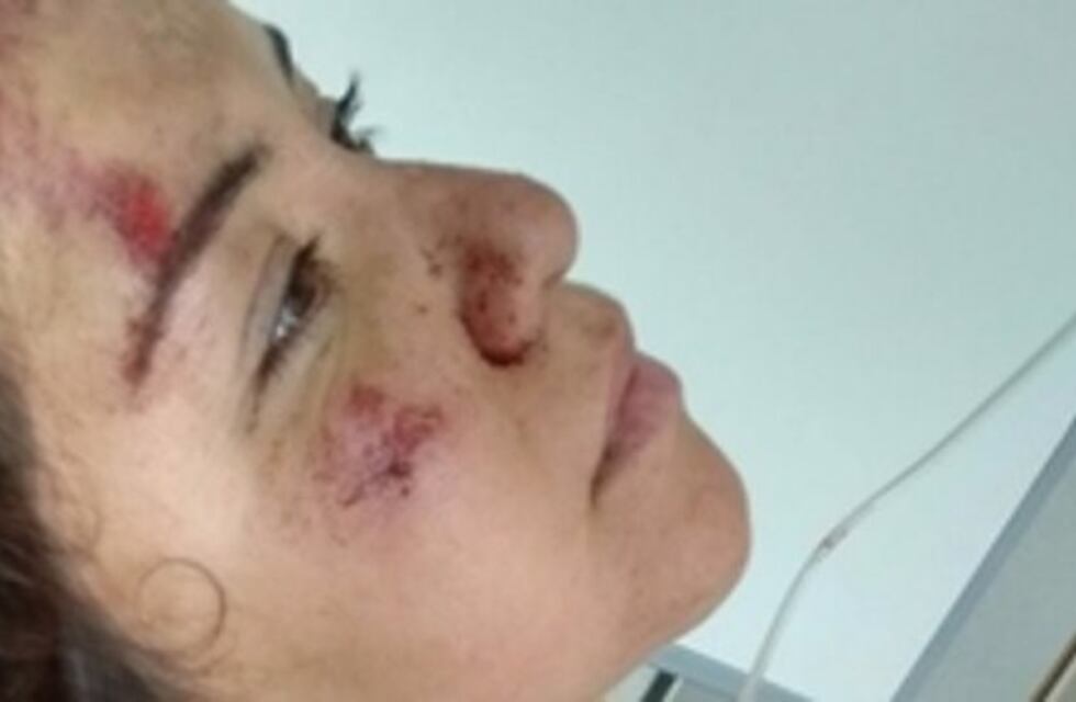 Apareció el conductor que atropelló a la joven y se presentaría ante la Justicia