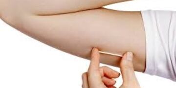 Implante sub dérmico anticonceptivo