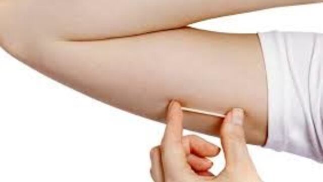 Implante sub dérmico anticonceptivo