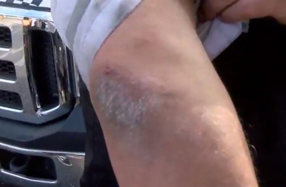 Agentes de tránsito fueron golpeados brutalmente por llevarse un auto al corralón