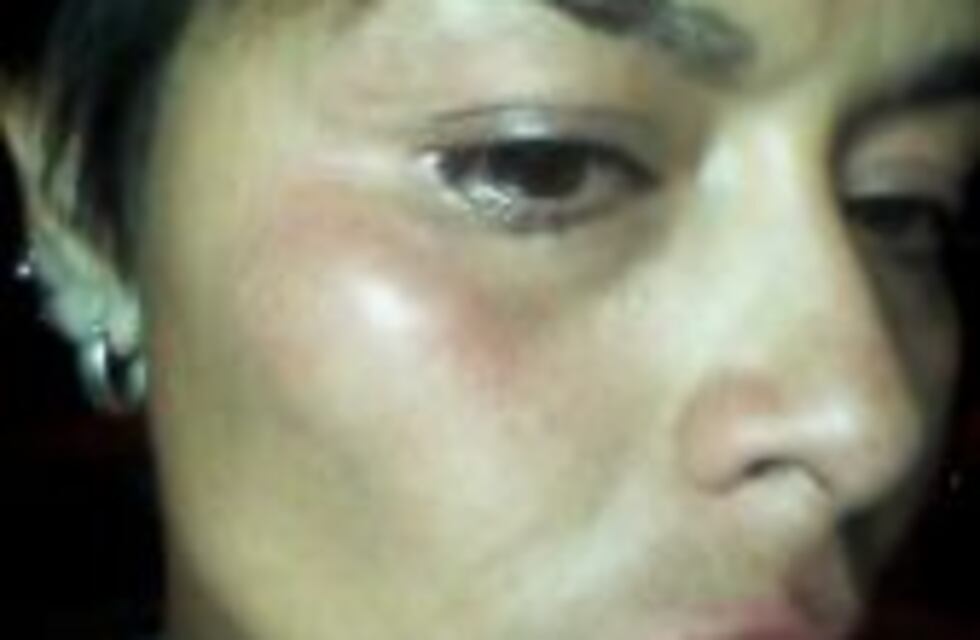 Cantante riocuartense denunció violencia de género