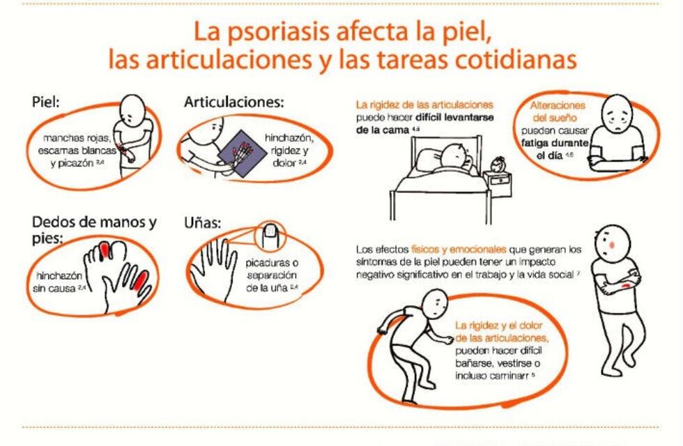 Campaña de detección gratuita de artritis psoriásica