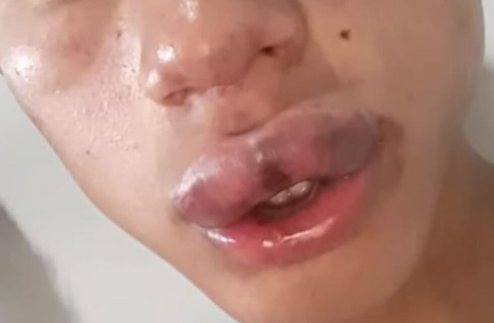 Detuvieron a integrante de una patota que golpeó ferozmente a un chico de 15 años