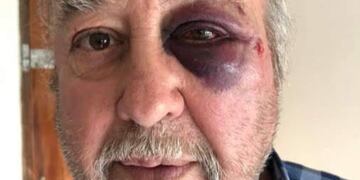 Hotelero agredido en Gualeguaychú\nCrédito: ElDía