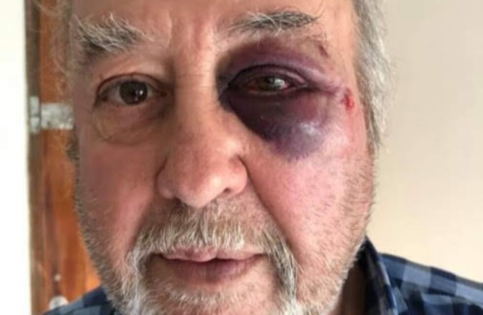 Intentó robar en un hotel agrediendo violentamente al dueño