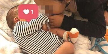 Rodrigo, el bebé sin rostro que nació en Portugal (Web)