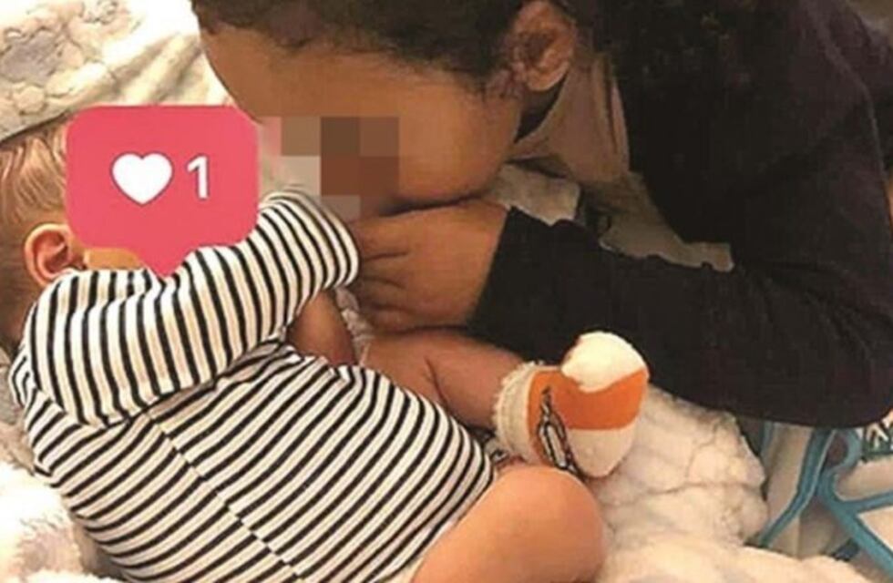 El "bebé sin rostro" cumplió dos meses y sus padres lo celebraron con un emotivo video