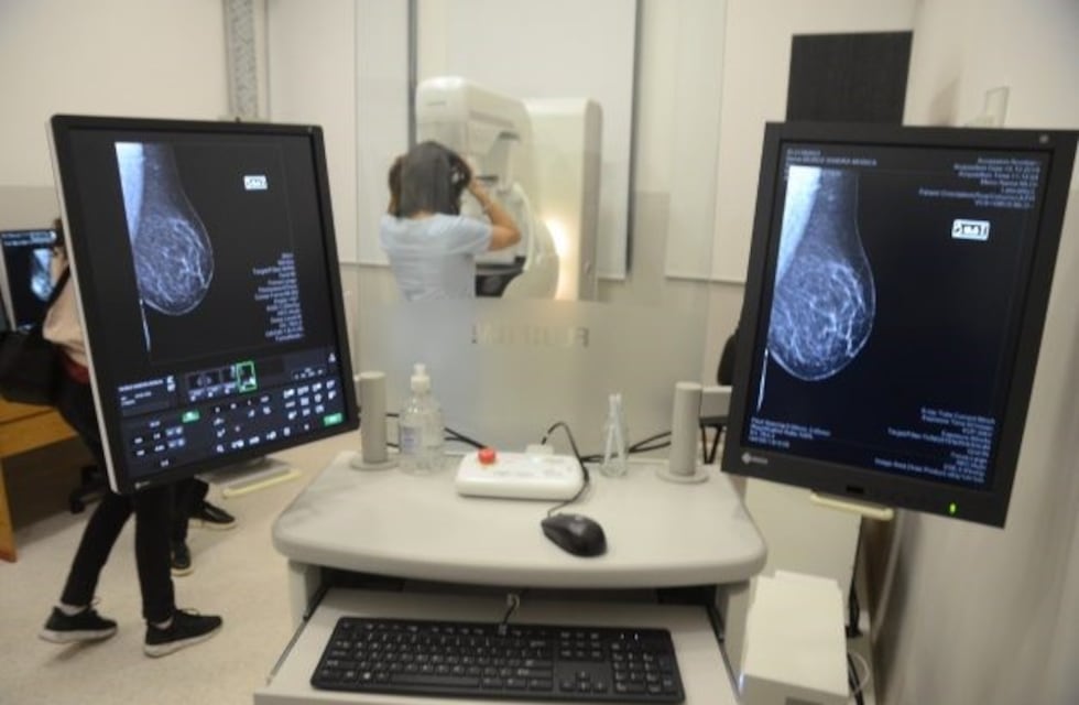 Realizaron más de 900 mamografías durante la campaña de prevención en San Luis