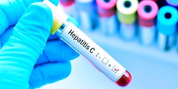 La OMS alertó sobre el inusual aumento de casos de hepatitis en niños de todo el mundo.