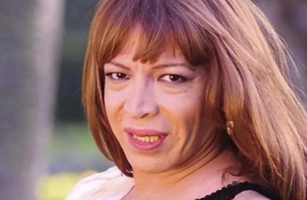 Así quedó Lizy Tagliani luego de su operación