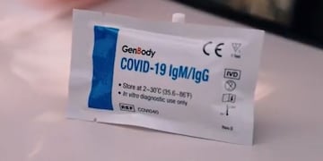 Test de coronavirus que se utiliza en Jujuy