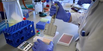 GRAF4291\u002E MADRID, 12/05/2020\u002E- Laboratorio de la empresa de biotecnología Eurofins Ingenasa en Madrid, este martes, donde desarrollan y producen test para la detección del Covid 19\u002E EFE/Fernando Villar