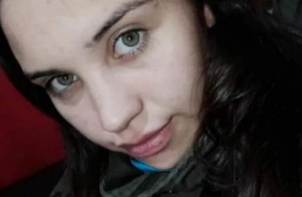Llegó al hospital con el 80% de su cuerpo quemado: el novio, que quedó detenido, dijo que se prendió fuego sola