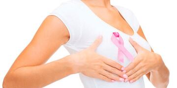 Cáncer de mama