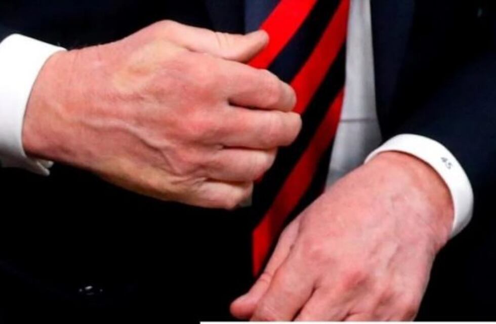 Emmanuel Macron dejó la marca de su pulgar en la mano de Donald Trump