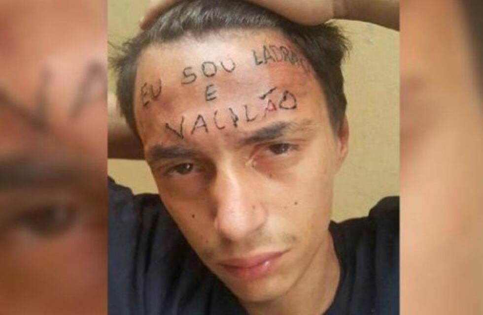 Quiso robar una bicicleta, le tatuaron en la frente "Soy ladrón y bobo" y ahora recaudan dinero para borrarle la inscripción
