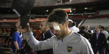 Pablo Pérez en el Monumental, con su ojo izquierdo vendado (AFP)