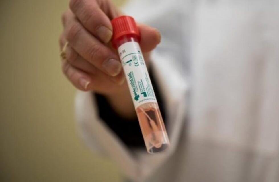 San Luis ya realiza tests de Covid-19 en sus laboratorios