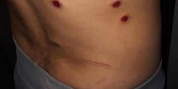 Ladrón herido\u002E