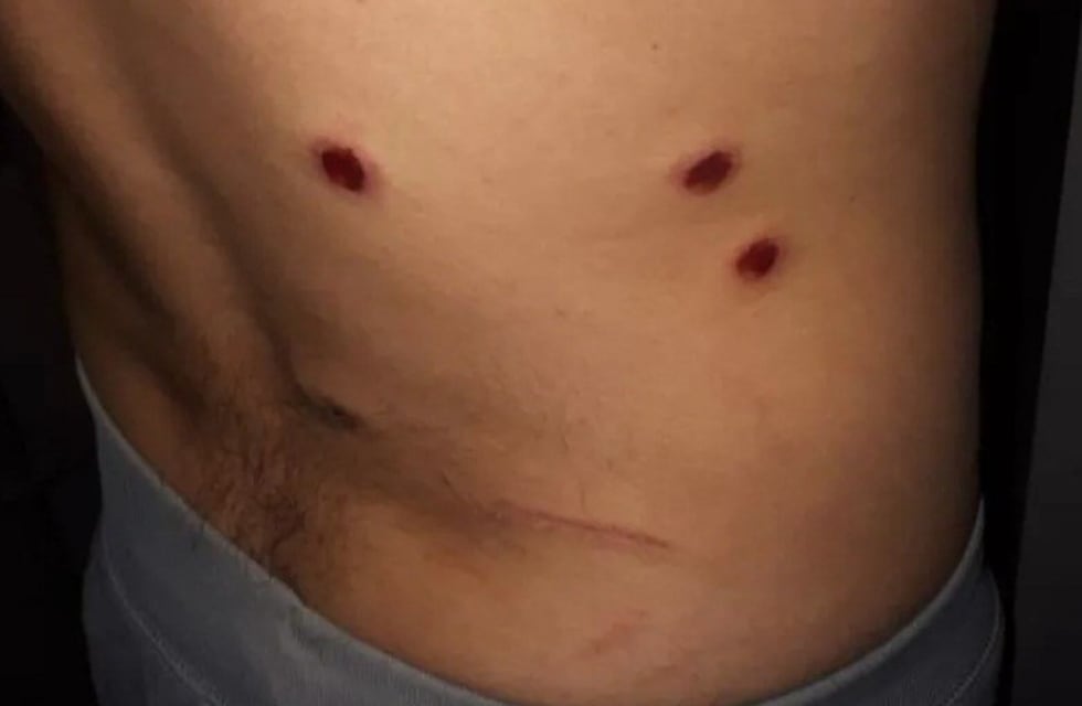 Persecución y tiroteo tras un violento robo a una familia sanjuanina