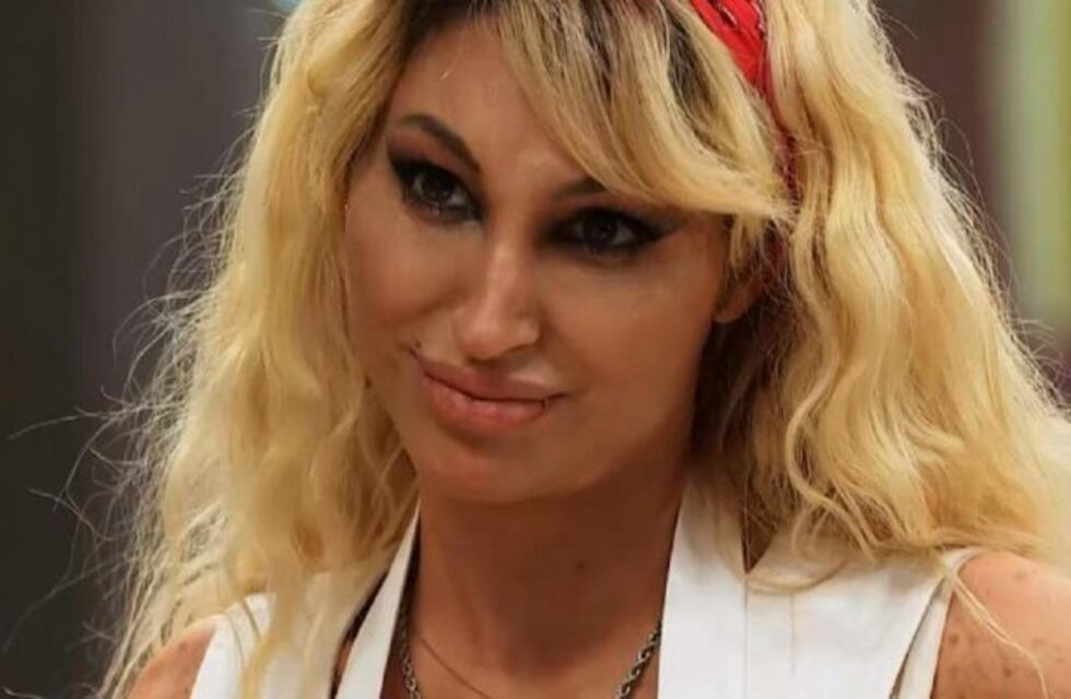 Masterchef Celebrity: Vicky Xipolitakis se presentó pese a que se "abrió toda la cara" en un accidente