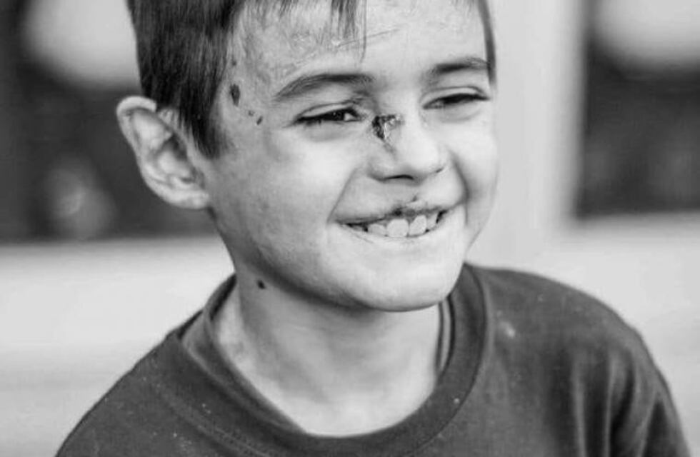 Juampi, el niño con piel de cristal, nos necesita