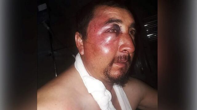 Puestero de Limay Mahuida golpeado por los hijos del intendente (AM 900)