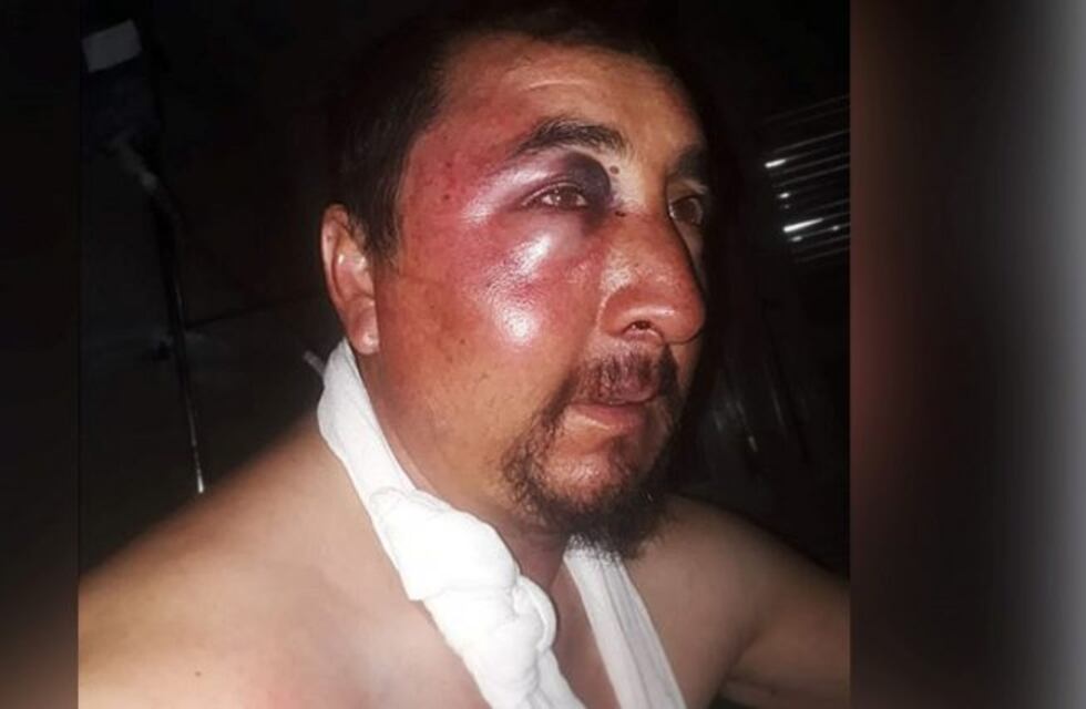 Los hijos del intendente de Limay Mahuida golpearon a un puestero