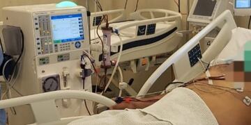 Equipo de diálisis del Hospital \